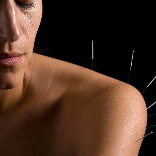 Acupuncture Chichester Natural Health Centre